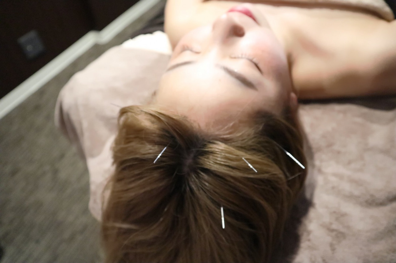 大阪市堀江の鍼灸院 「頭皮鍼」：ハリスパ堀江院